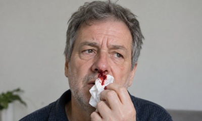 Krv iz nosa bez očiglednog razloga: Šta najčešće iritira krvne sudove