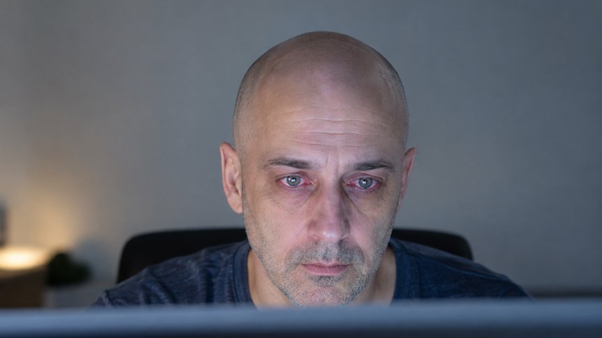 umor očiju, ekran, treptanje, suvo oko, vid, zamor očiju, kulijana, kulijanars